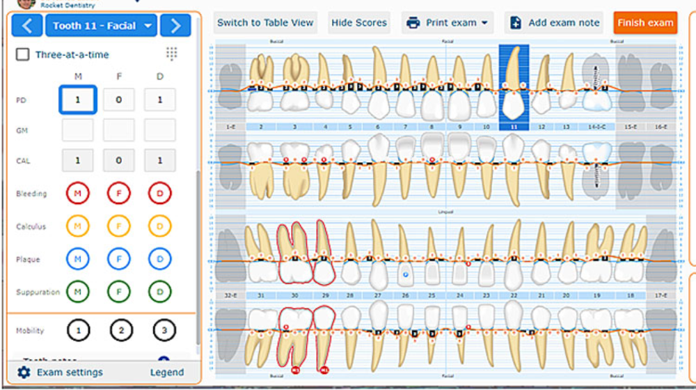 Periodontal Chart Online Derec Online Dental Charting